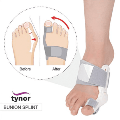 Tyn Bunion Splint Univ