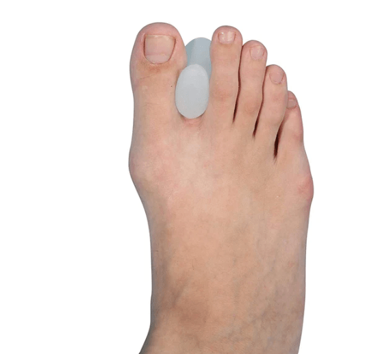 Tyn Toe Separator